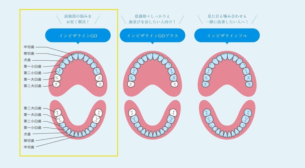 インビザラインGOとは