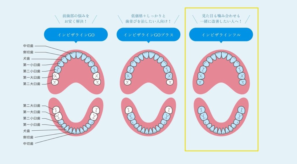 インビザラインフルとは