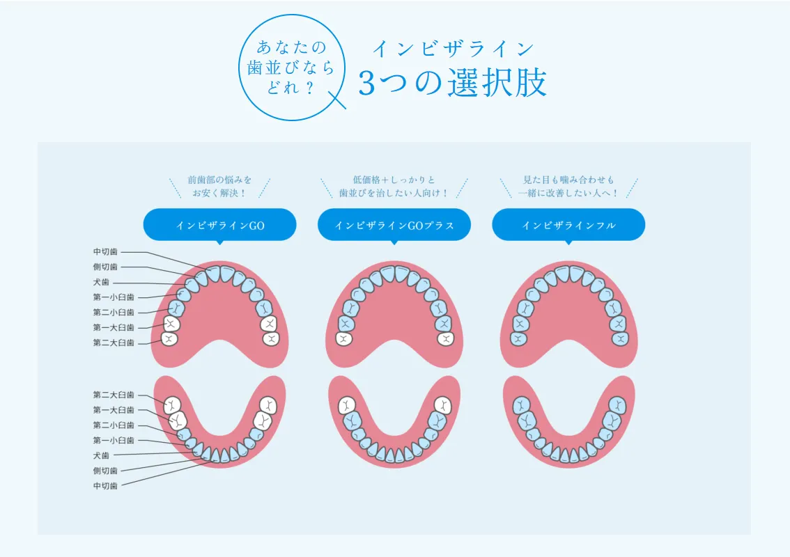 インビザライン３つの違い
