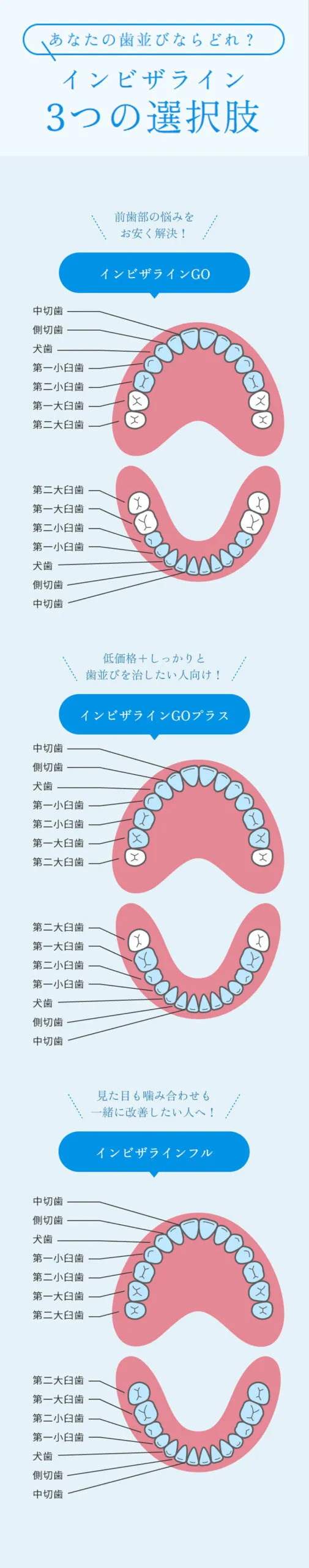 インビザライン３つの違い